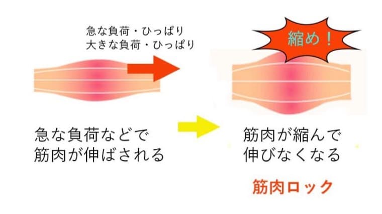 筋肉ロックの解説