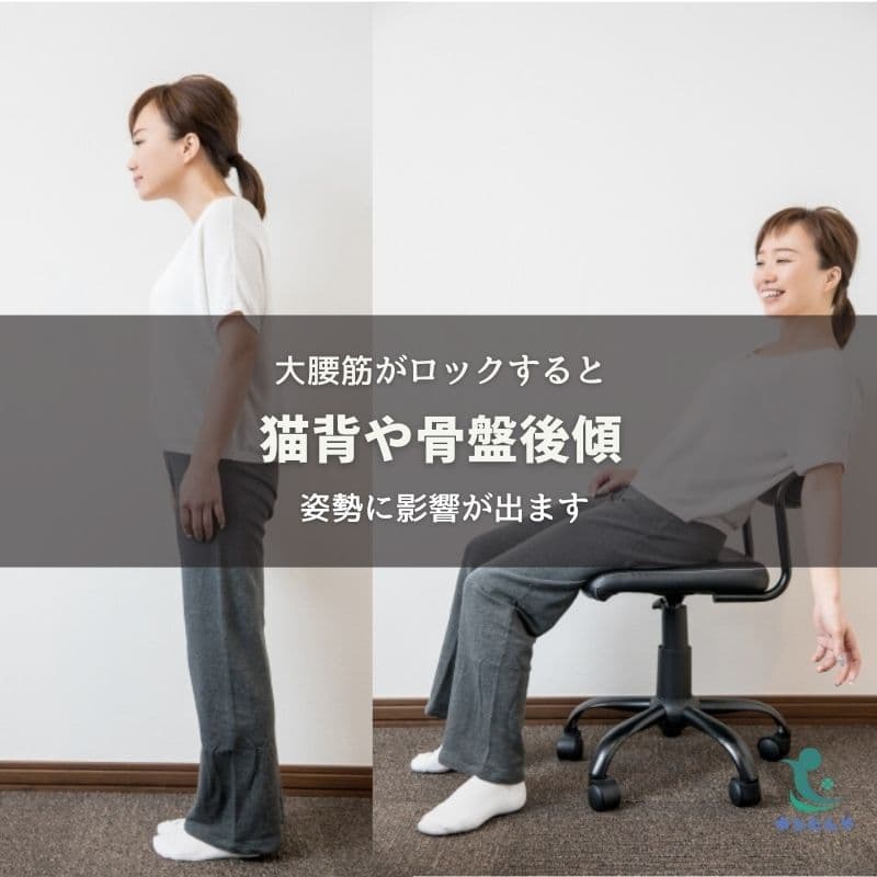猫背や反り腰は大腰筋のロックが関係?のイメージ画像